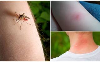 Как отличить укус комара от укуса клопа у ребенка