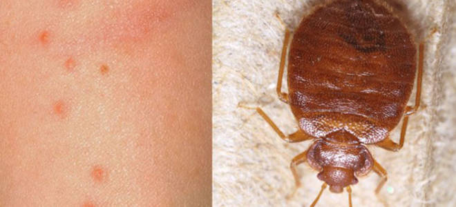 Как отличить клеща от клопа