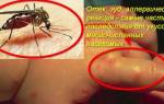 Мазь против укусов насекомых