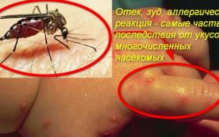 Мазь против укусов насекомых