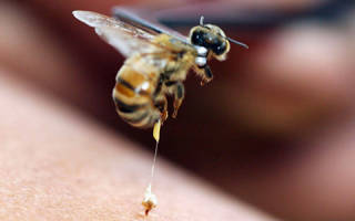 Первая помощь при укусе пчелы в домашних условиях